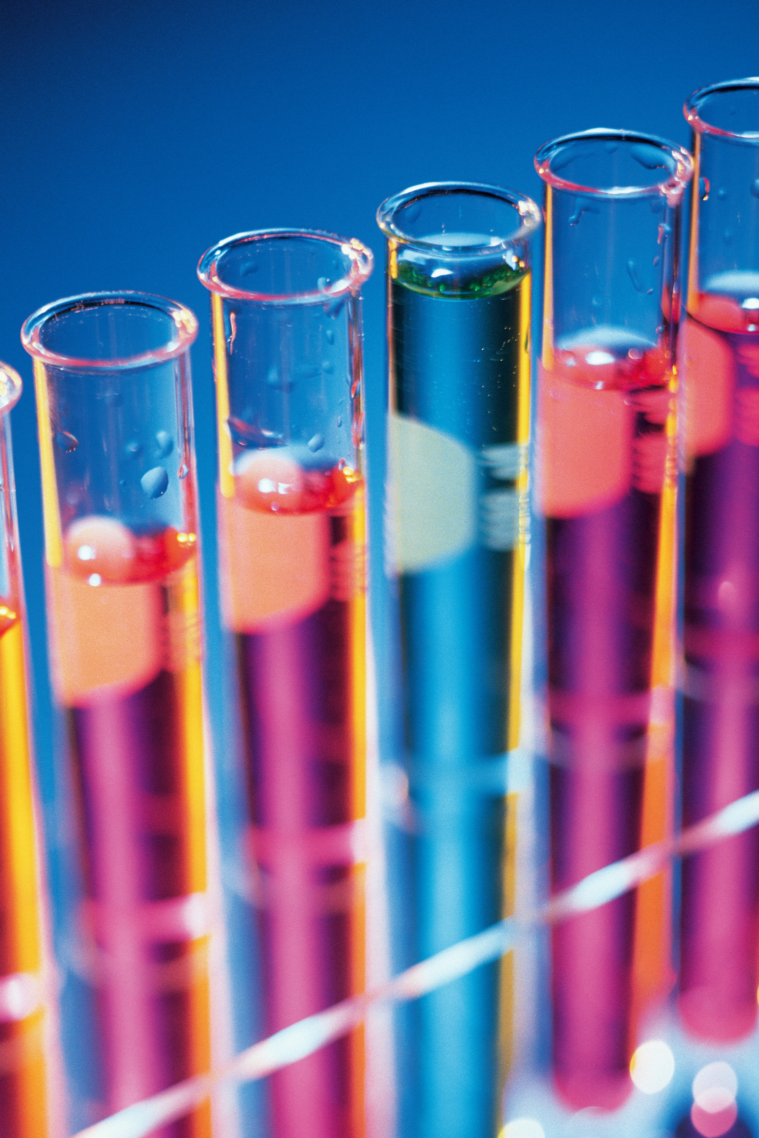 Cipla Foundation brings chronic medicine closer to Tembisans - BizHealthcare - 26 November 2019